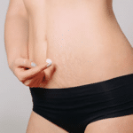 Woman adding lotion to her belly